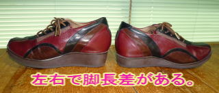      左右で脚長差がある。